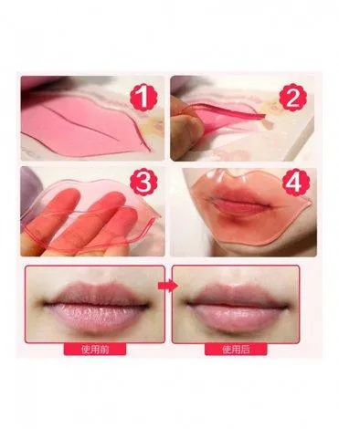 Kiss Kiss Lovely Lip Patch